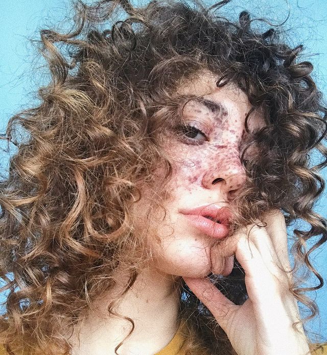 Модель з незвичайними веснянками підкорила Instagram- фото 228941