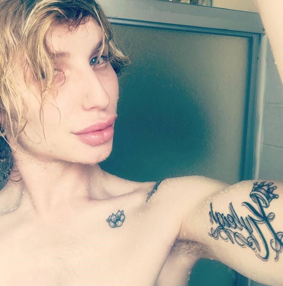 Хлопець пережив понад 40 операцій, щоб перетворитися в Кайлі Дженнер, і ось що вийшло