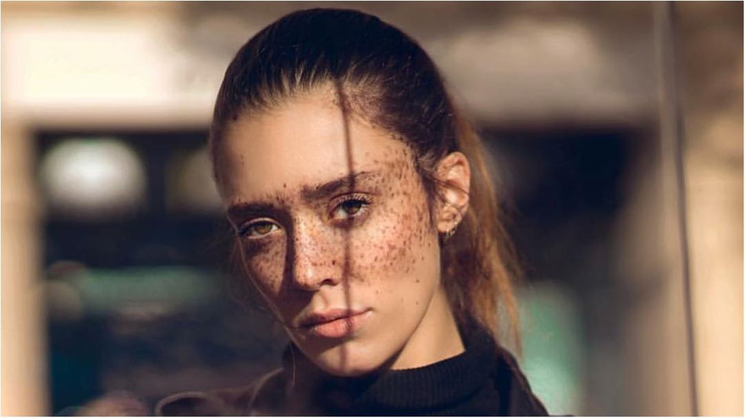 Модель з незвичайними веснянками підкорила Instagram