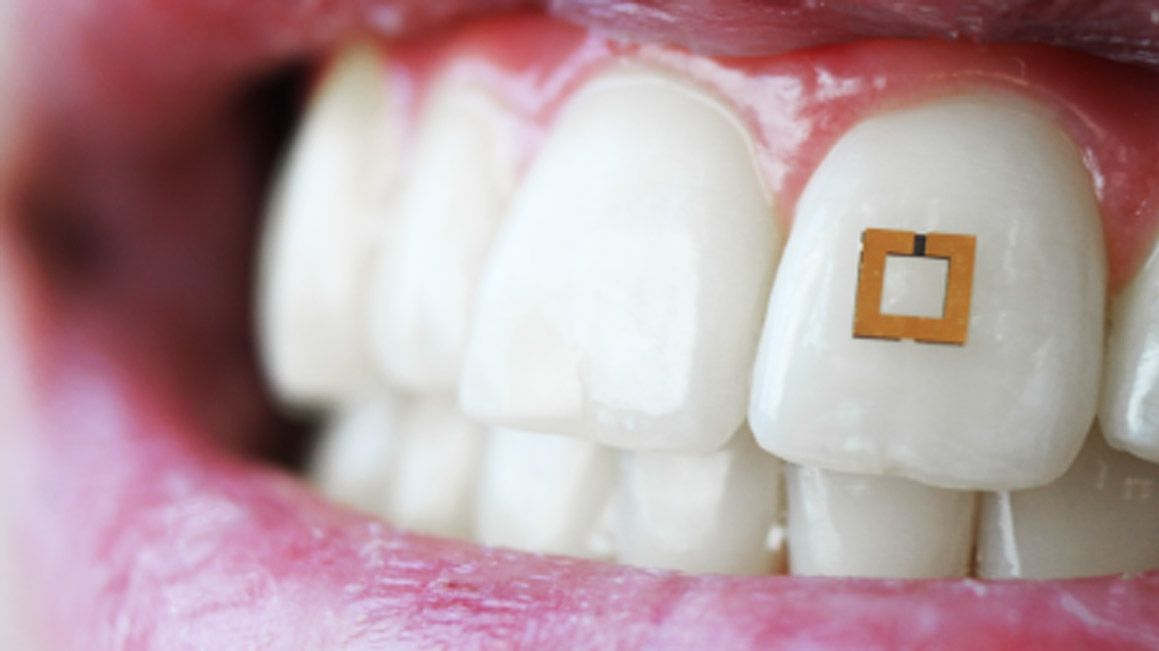 Винайдено зубну наклейку, що слідкує за кількістю калорій