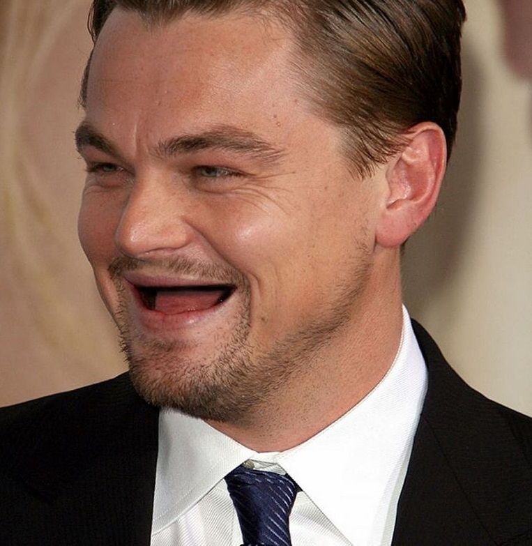 Голлівудська посмішка? Як виглядають зірки без зубів: епічні фото