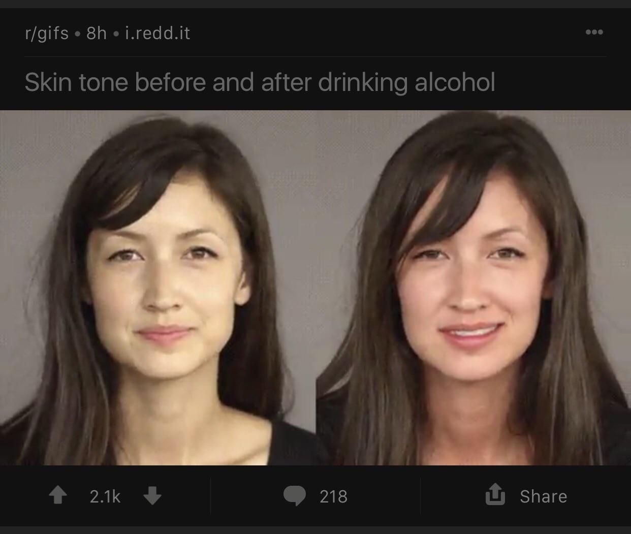 Як виглядає обличчя до алкоголю і після: відеофакт