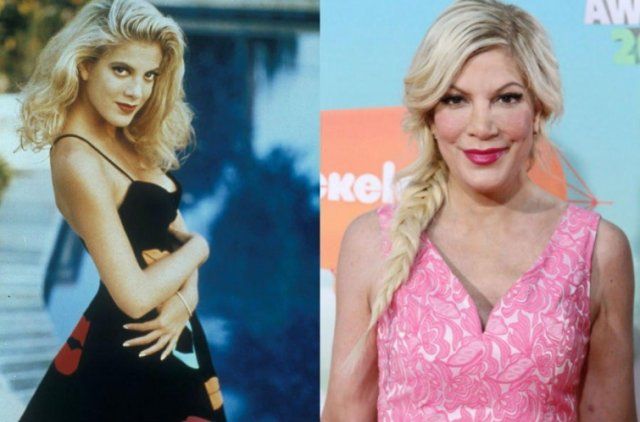 У зірки серіалу Беверлі-Хіллз стався нервовий зрив