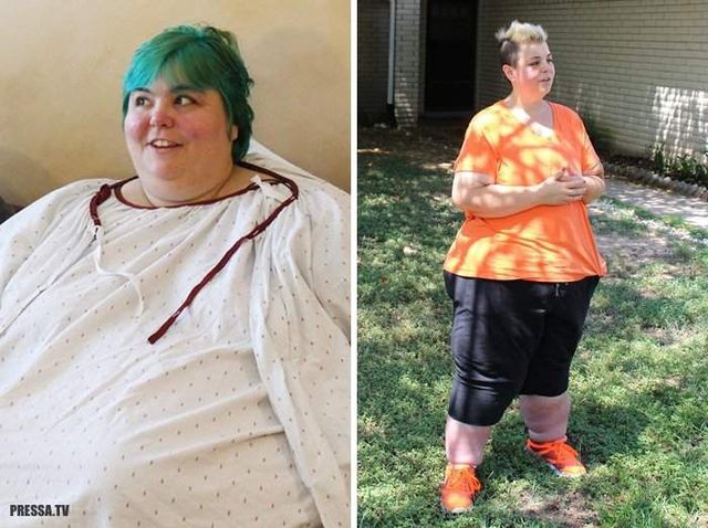 Шокуючі результати схуднення на проекті 'Я важу 300 кг'- фото 243454