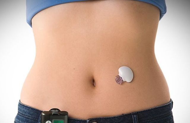 Грецькі вчені довели ефективність штучної підшлункової залози - фото 241856