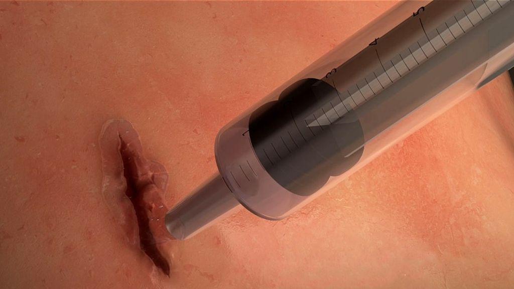 MeTro наносять безпосередньо на розріз - фото 1