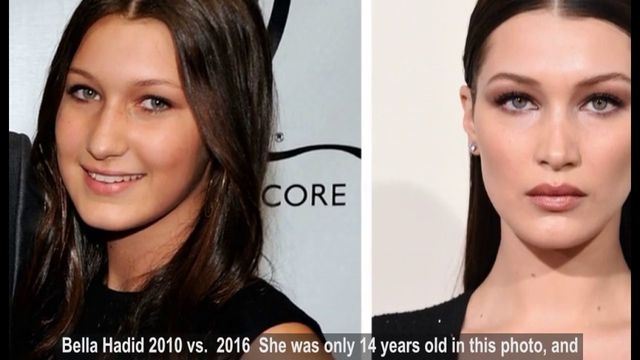 Белла Хадід розповіла про своє ставлення до пластики- фото 251943