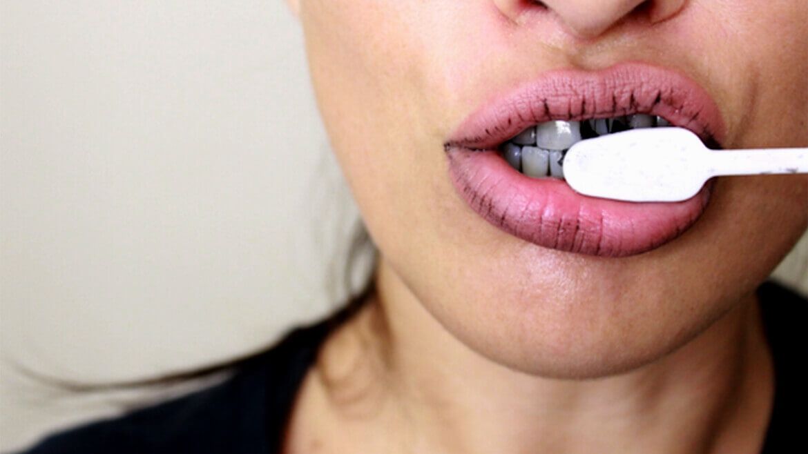 Ці продукти відбілюють зубну емаль