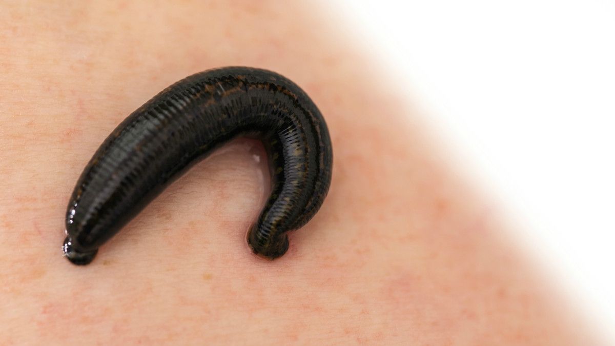 Втеча п'явки з лікарні стала хітом мережі