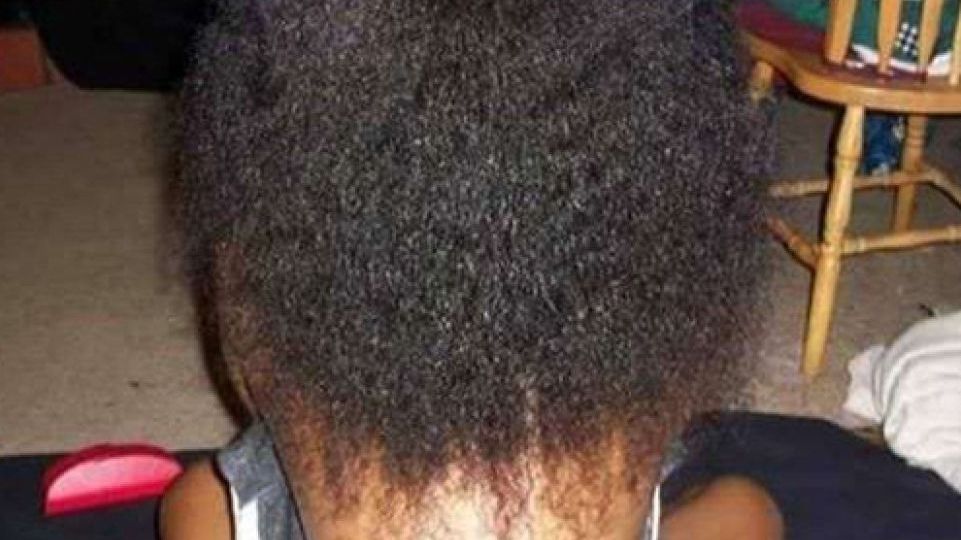 Шия чи спина: у мережі ламають голову над новою ілюзією