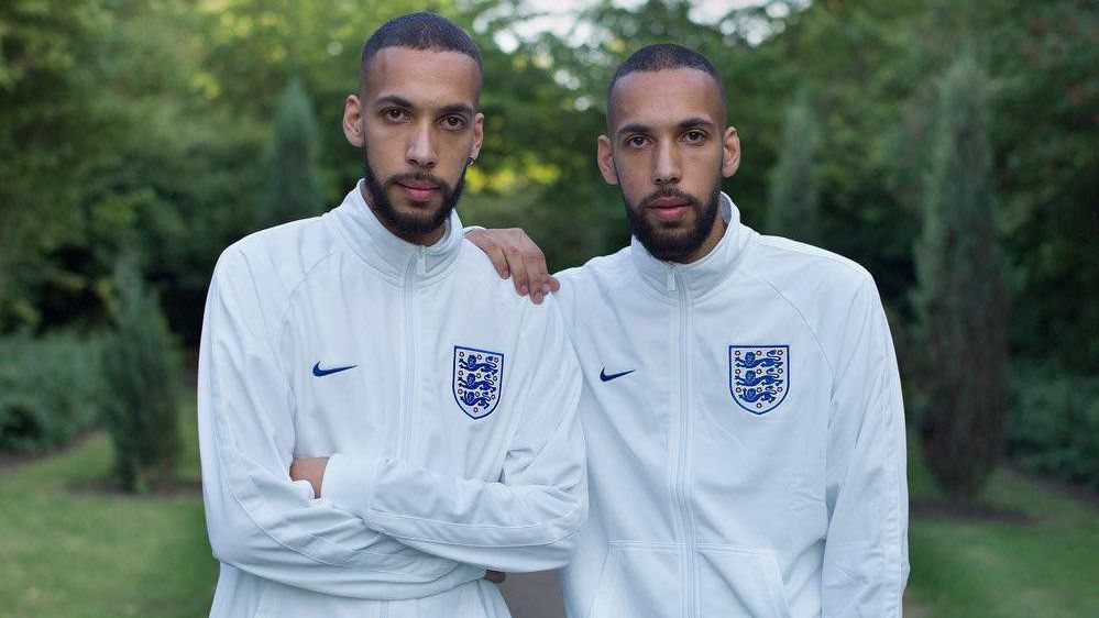 Фотограф показав, наскільки різними можуть бути близнюки