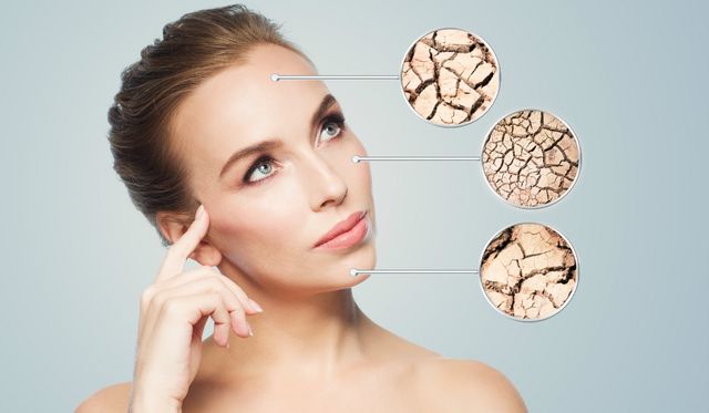 Цукор негативно впливає на шкіру - фото 292121