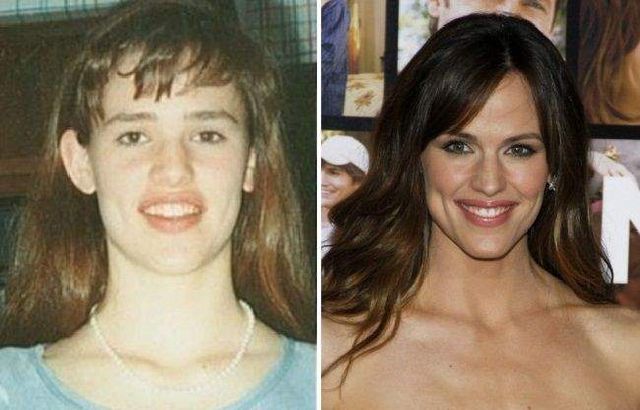 Ці зірки у дитинстві були гидкими каченятами: фото - фото 286501