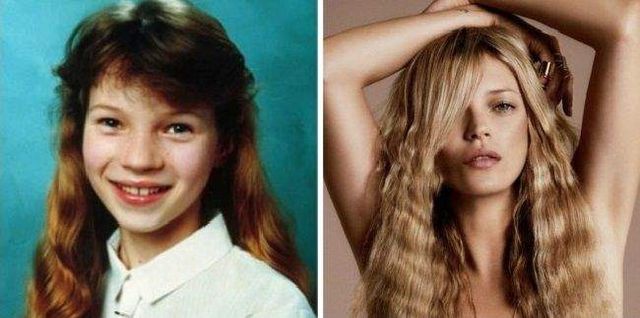 Ці зірки у дитинстві були гидкими каченятами: фото - фото 286490