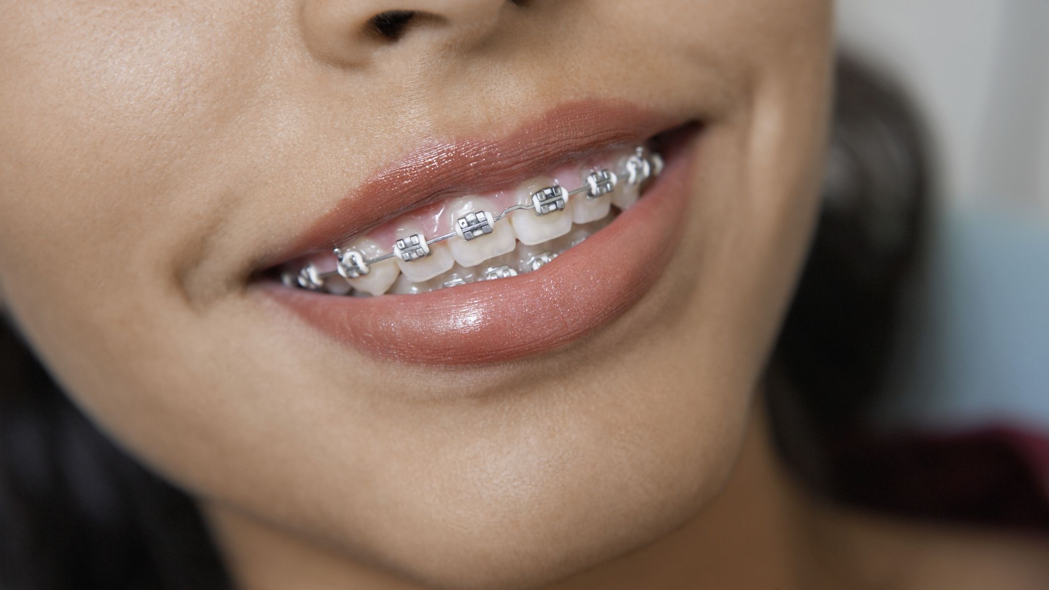 Стоматологи попередили про шкоду тушкованих овочів