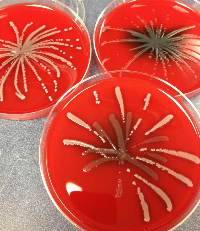 Мікробіолог створює малюнки за допомогою бактерій - фото 300538