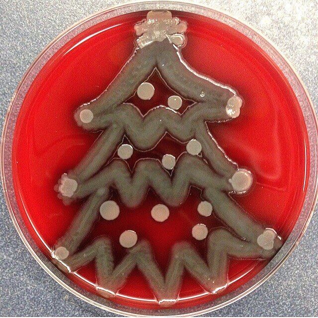 Мікробіолог створює малюнки за допомогою бактерій - фото 300541
