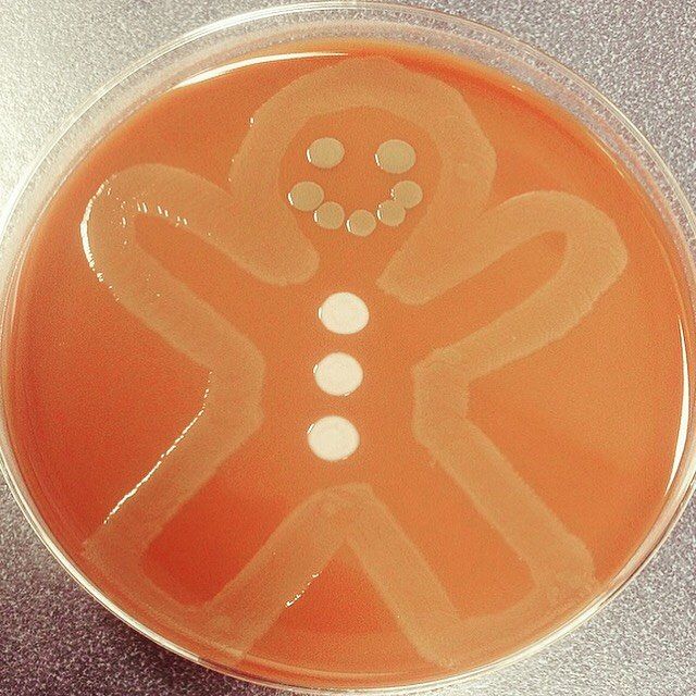 Мікробіолог створює малюнки за допомогою бактерій - фото 300542