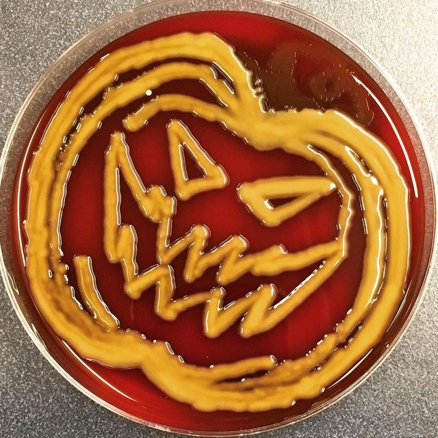 Мікробіолог створює малюнки за допомогою бактерій - фото 300544