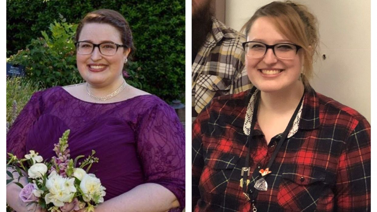 Медсестра показала, як змінилась за 4 місяці - фото 1