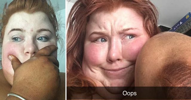 Дівчина перевіряла на собі автозасмагу і дуже про це пошкодувала - фото 338767