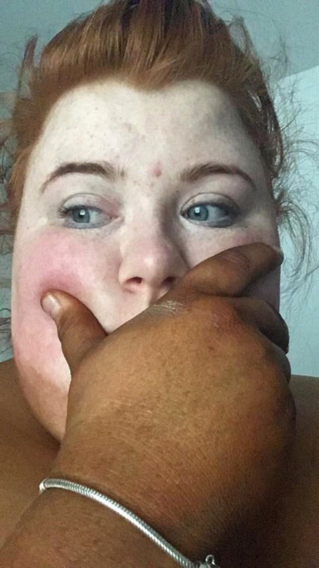 Дівчина перевіряла на собі автозасмагу і дуже про це пошкодувала - фото 338770