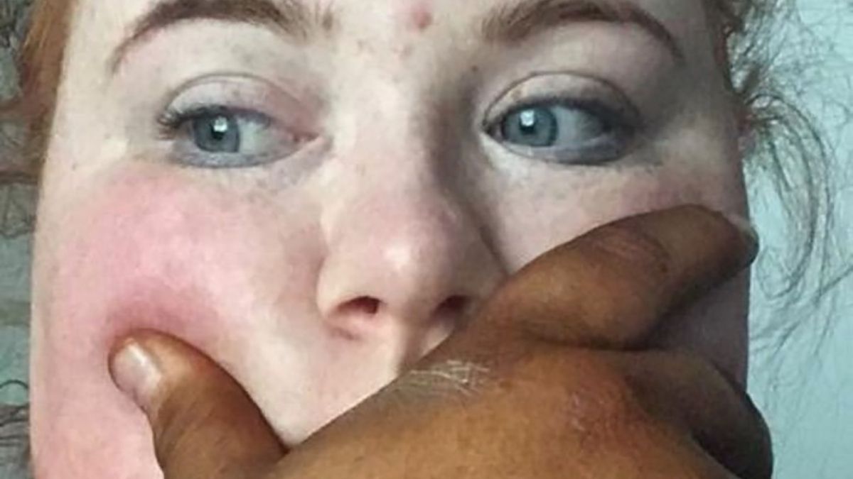 Дівчина перевіряла на собі автозасмагу і дуже про це пошкодувала