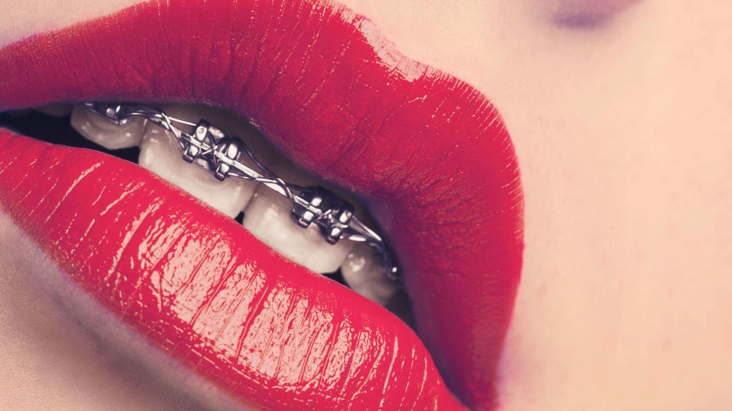 10 дурних запитань, які ти соромився поставити стоматологу