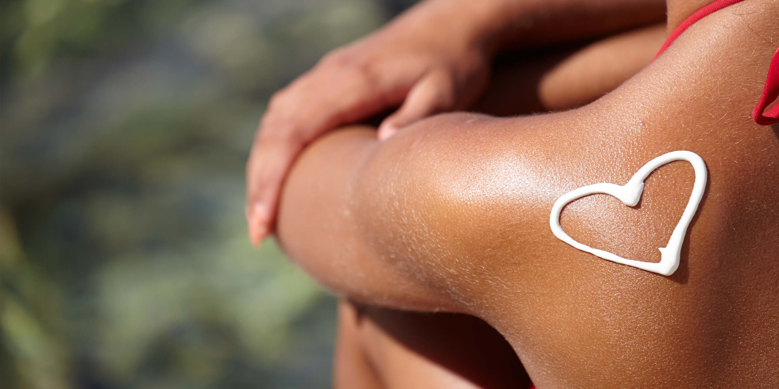 Сонячний опік: чого категорично не можна робити та як надати першу допомогу