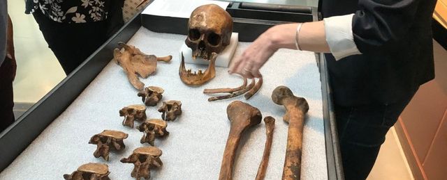 Науковці розкрили таємницю людини-вампіра - фото 345581