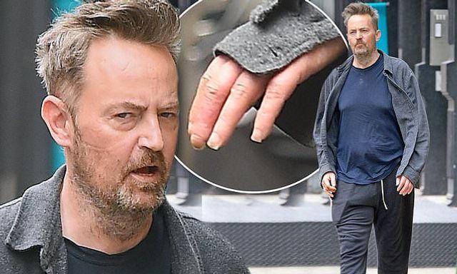 Зірка Друзів жахнув шанувальників зовнішнім виглядом (фото) - фото 346661