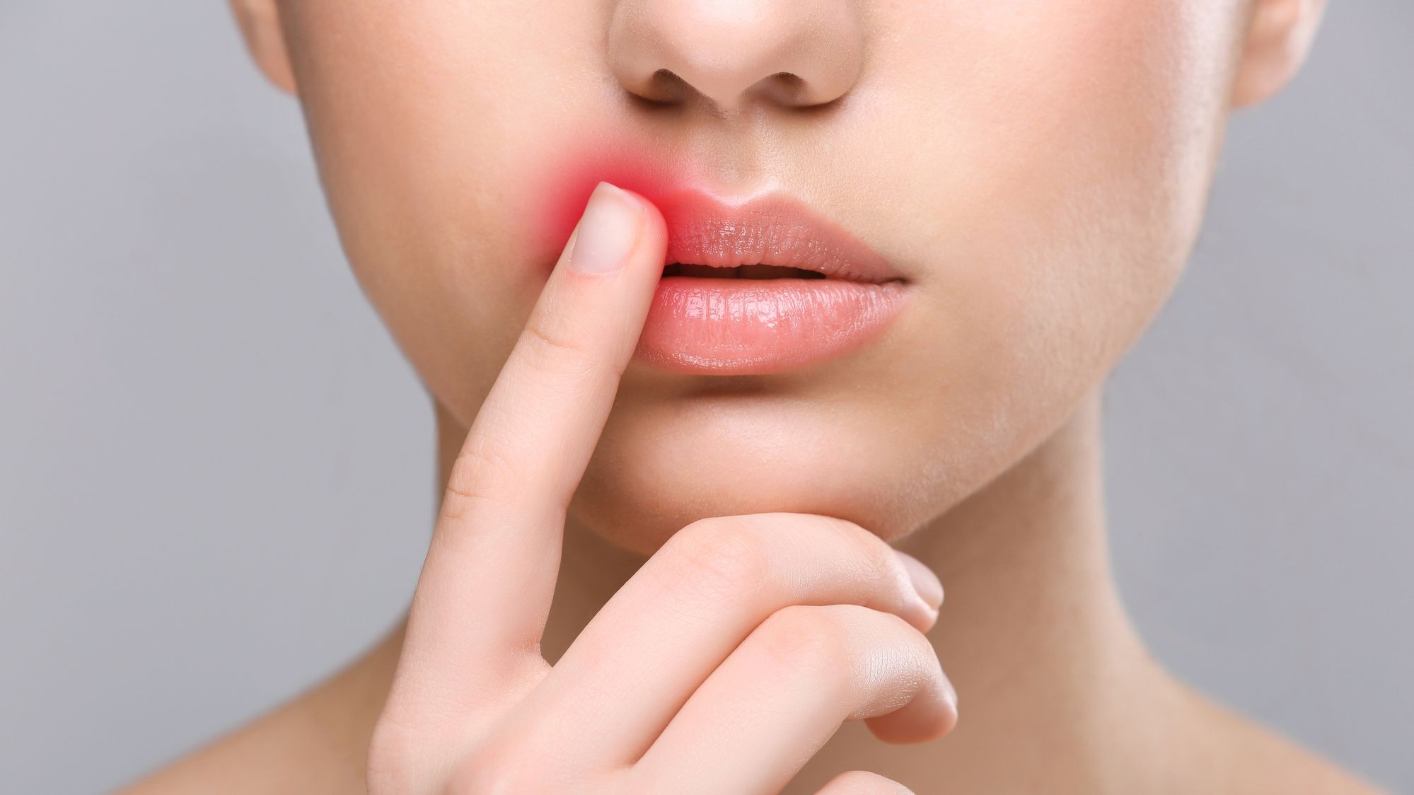 Супрун підказала, як правильно лікувати герпес