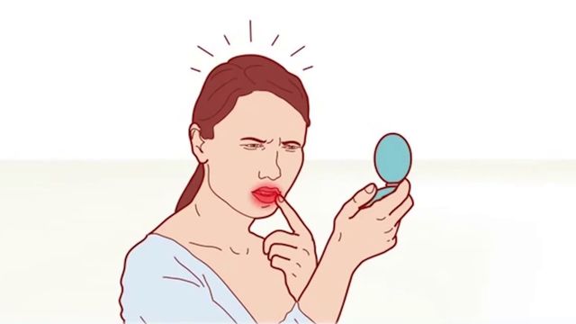 Що таке герпес- фото 348149