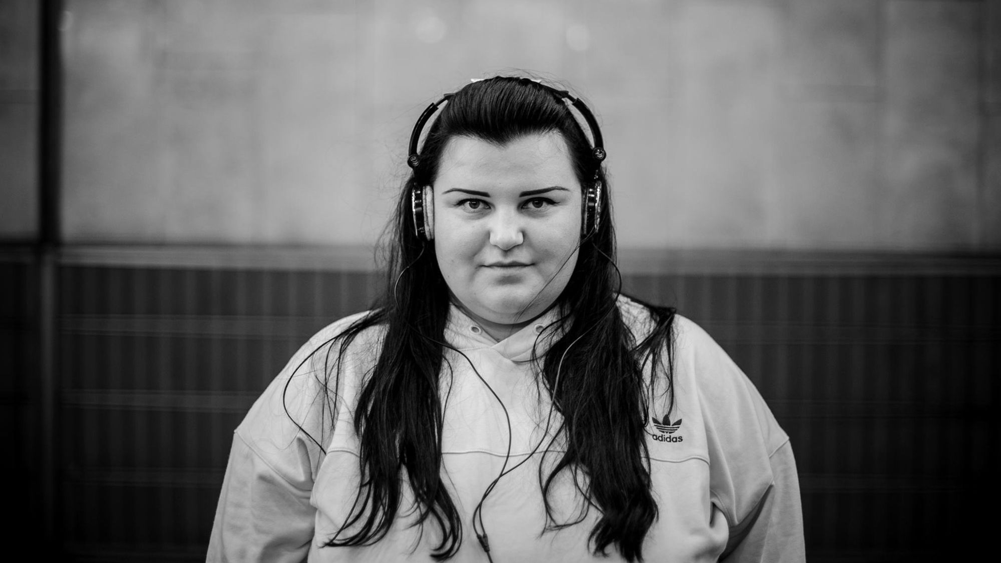 Аlyona alyona "проколола" собі чоло виделкою (фотофакт)