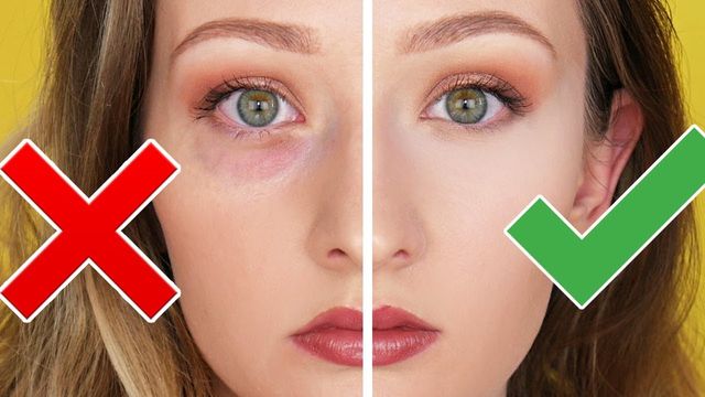 Медики назвали несподівані причини мішків під очима - фото 349598