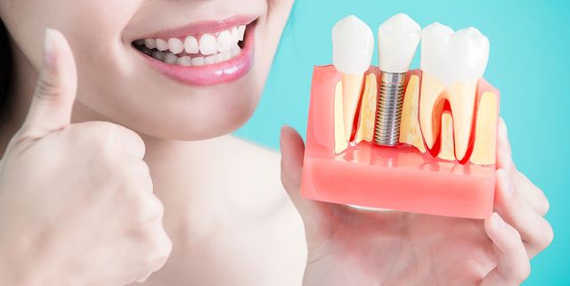 Як самостійно вгамувати біль від зуба мудрості: поради лікарів - фото 351408