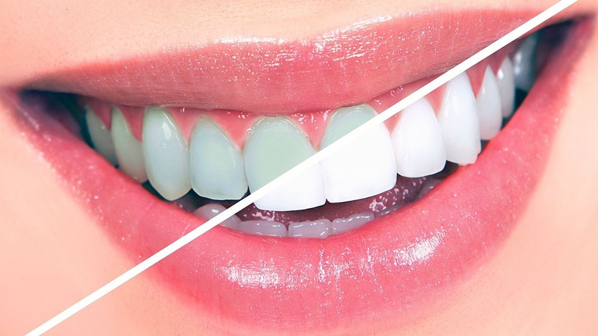 Що шкодить нашим зубам - фото 1