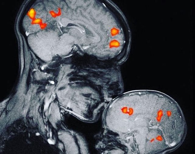 Так реагує мозок на поцілунок мами і дитини: видовищний знімок - фото 354792