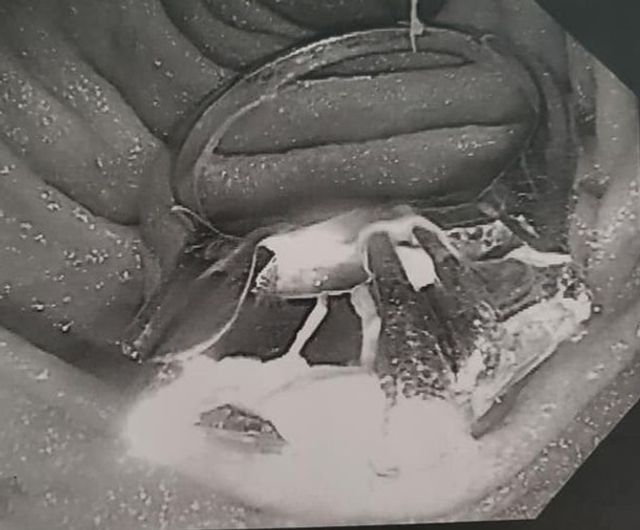 Дівчина з'їла свій перстень уві сні: її переслідували грабіжники - фото 355446