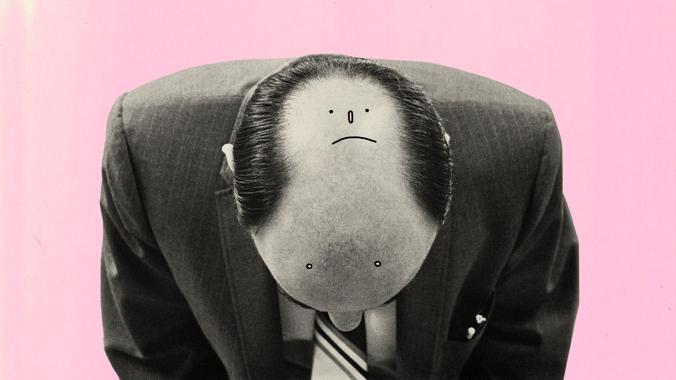 Названа несподівана причина облисіння