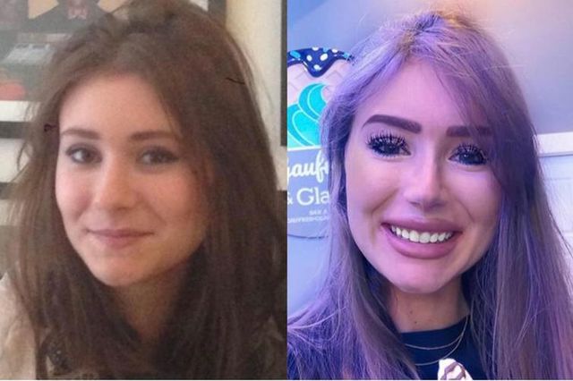 Як виглядають красуні з Instagram у реальному житті - фото 362084