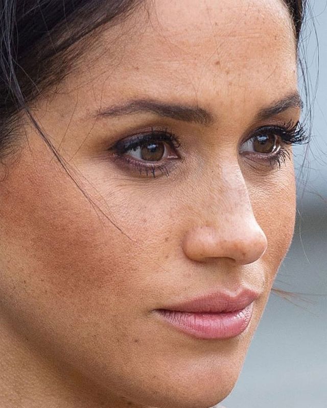 Зовсім не ідеальні: як виглядають зірки зблизька (фото) - фото 366417