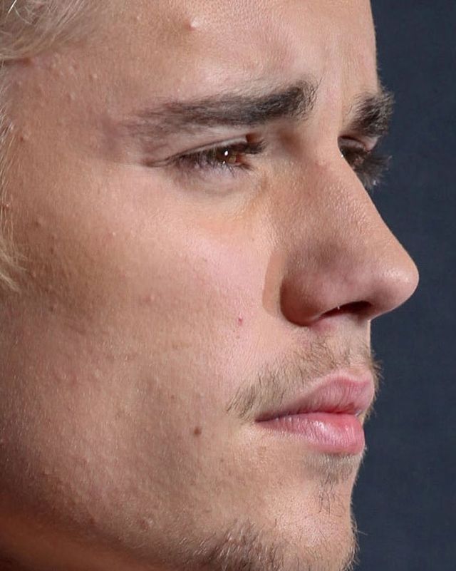 Зовсім не ідеальні: як виглядають зірки зблизька (фото) - фото 366424