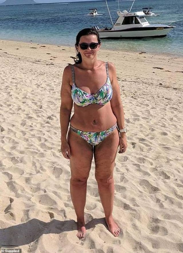 Як ігрова приставка допомогла американці схуднути на 63 кг - фото 370151