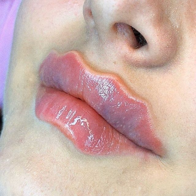 Косметологічний тренд на нову форму губздивував інтернет: фотофакт - фото 371198