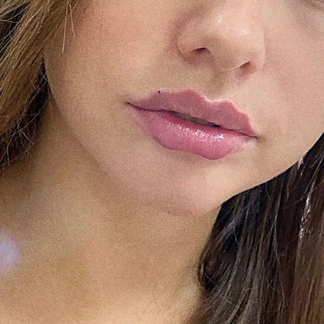 Косметологічний тренд на нову форму губздивував інтернет: фотофакт - фото 371199