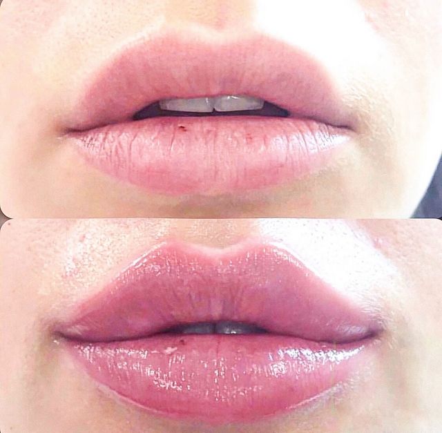 Які жіночі губи категорично не подобаються чоловікам - фото 372696