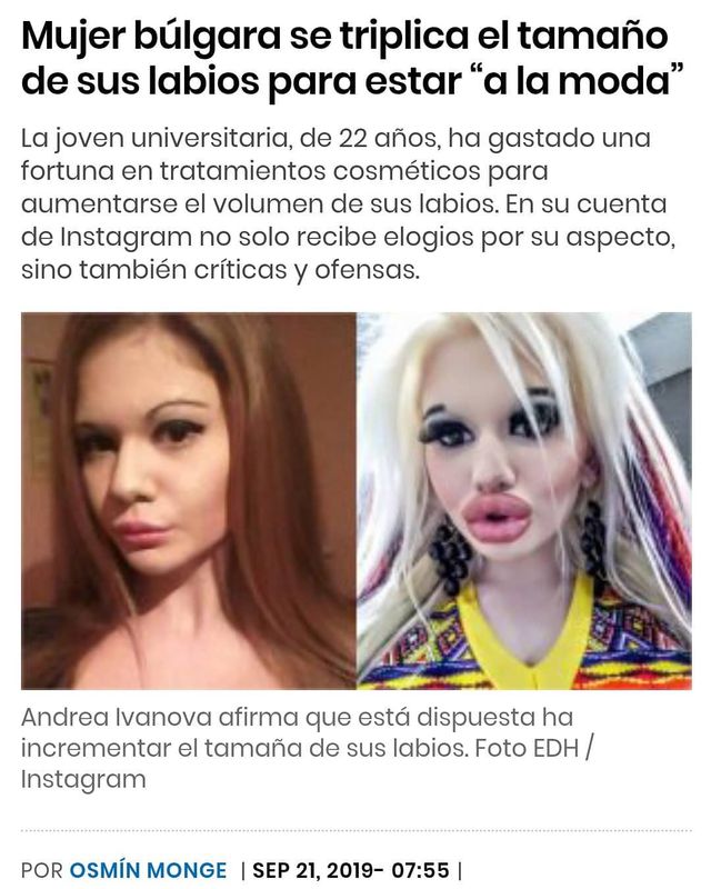 Болгарська студентка зробити десяток операції, щоб стати Барбі - фото 375747