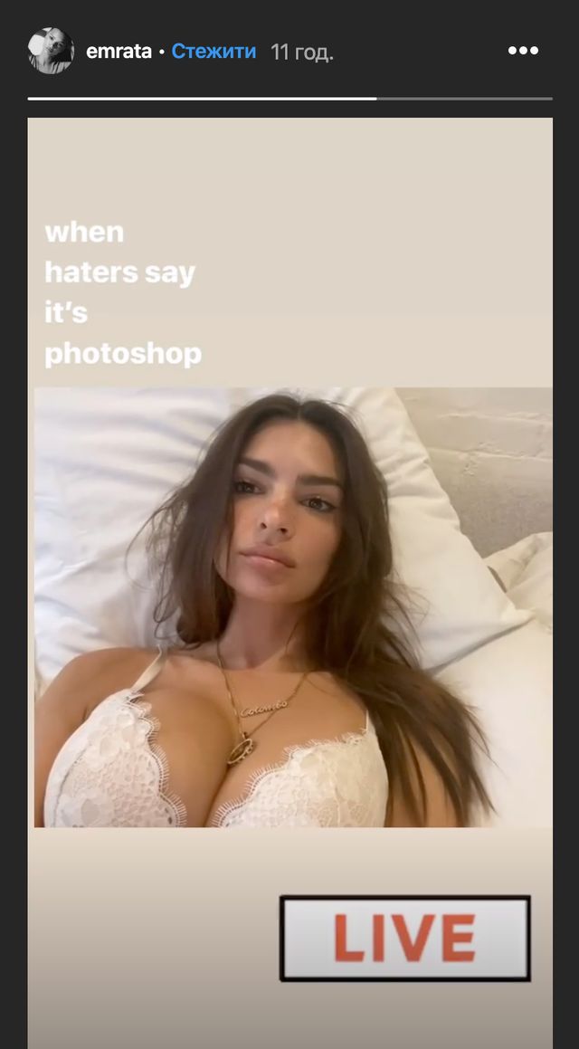 У сторіз Емілі довела, що у неї все своє - фото 377245