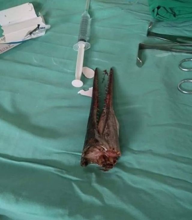 Риба стрибнула в човен і наскрізь проткнула рибалці шию: фотофакт - фото 381988